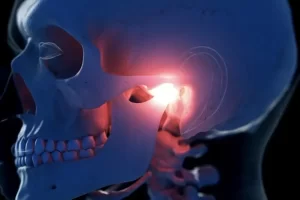Disfunção Temporomandibular DTM