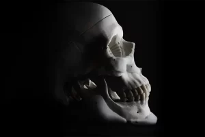 implantes faciais rígidos